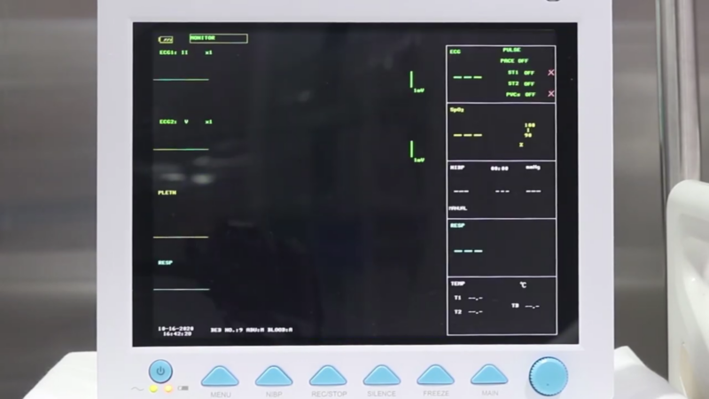 monitor csm china chinezesc spital