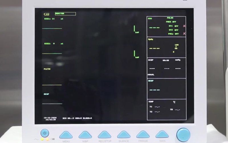 monitor csm china chinezesc spital