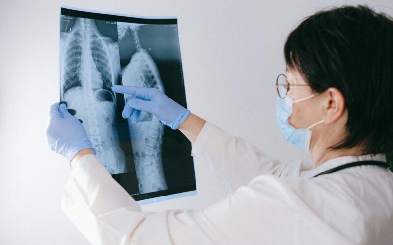 Radiografie a capacității pulmonare