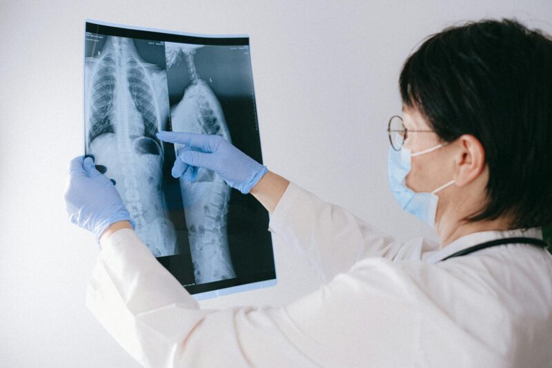 Radiografie a capacității pulmonare
