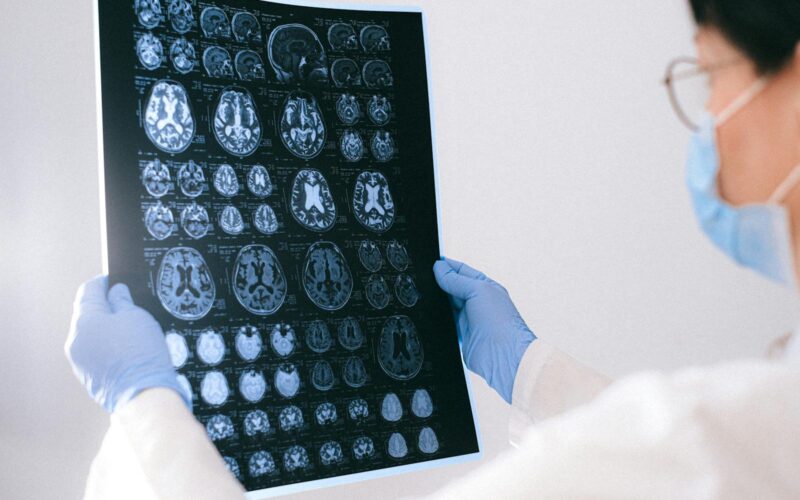 A medical professional reviewing MRI brain scans in a clinical setting, highlighting healthcare technology.