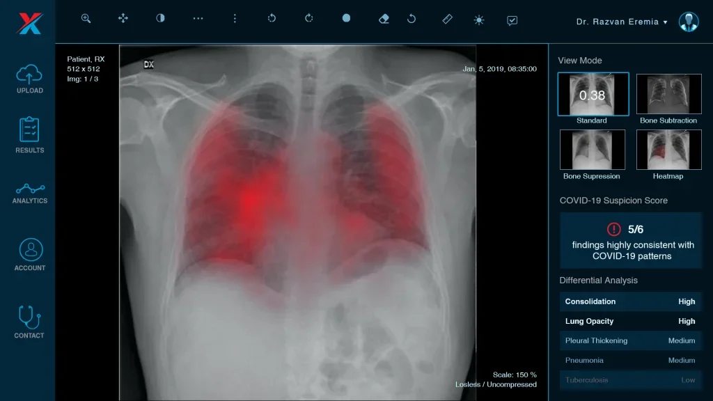 Film versus realitate: Inteligența Artificială, de la computere malefice la instrumentul salvator de vieți din medicina de azi. Dr. Dragoș Cuzino: „În medicină, AI-ul nu are autonomie și nu ia decizii pe cont propriu”