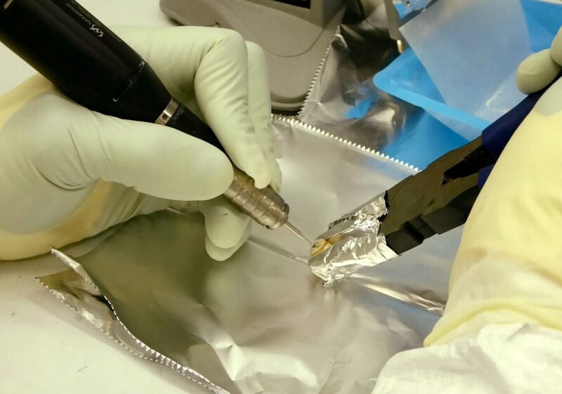 Yersinia pestis identificată în fosile de acum 1500 de ani