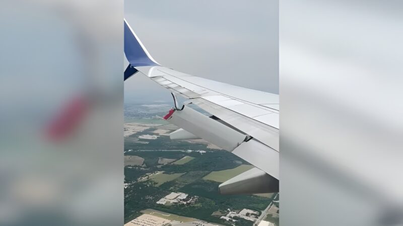 flaps rupt