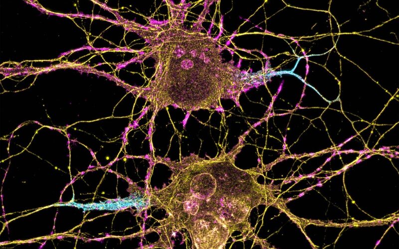 Neuroni
