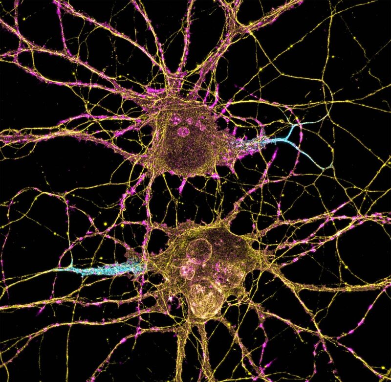 Neuroni