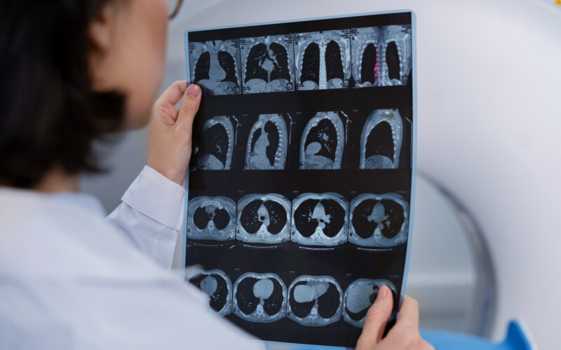 un medic se uita la o radiografie