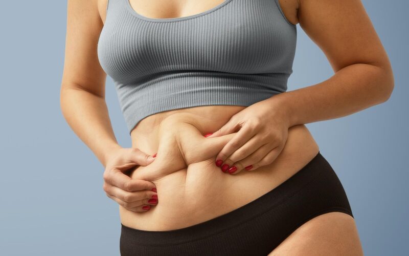 femeie supraponderala